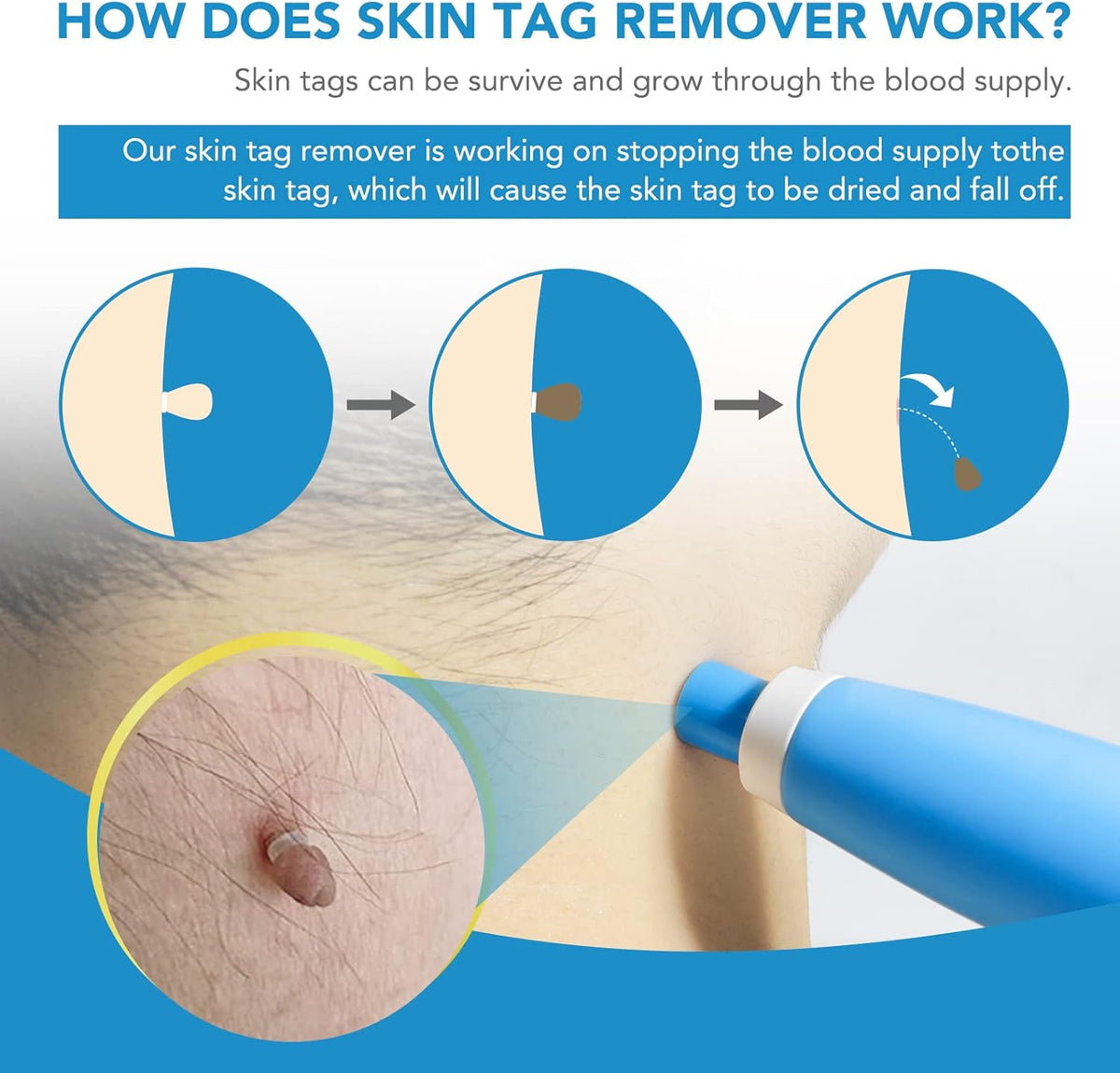 TagAway