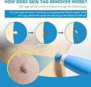 TagAway